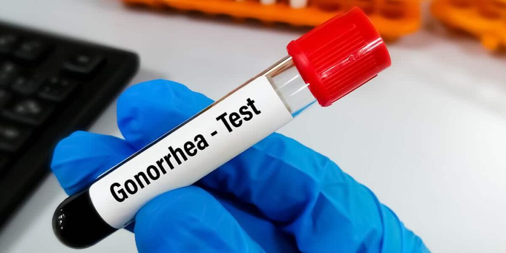Gonorrhea Testing Methods