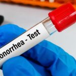 Gonorrhea Testing Methods